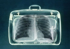 Suitcase Chest Xray